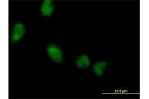 Immunofluorescence of purified MaxPab antibody to LMCD1 on HeLa cell.