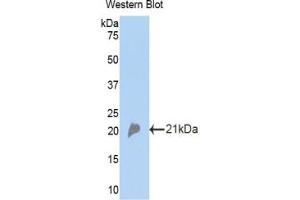 Detection of Recombinant CFP, Mouse using Polyclonal Antibody to Complement Factor P (CFP) (CFP Antikörper  (AA 310-459))