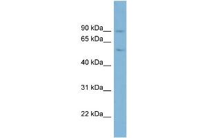 WB Suggested Anti-PLG  Antibody Titration: 0. (PLG Antikörper  (Middle Region))