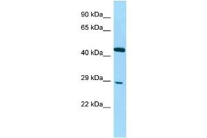 Host: Rabbit Target Name: DNAJC8 Sample Type: Jurkat Whole Cell lysates Antibody Dilution: 1. (DNAJC8 Antikörper  (C-Term))