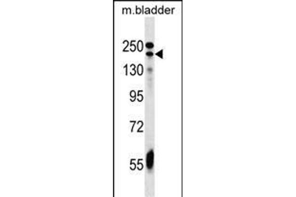 ADCY9 Antikörper  (C-Term)