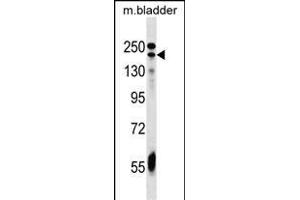 ADCY9 Antibody (C-term) (ABIN1536696 and ABIN2849404) western blot analysis in mouse bladder tissue lysates (35 μg/lane). (ADCY9 Antikörper  (C-Term))