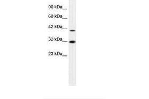 Image no. 1 for anti-Interferon Regulatory Factor 2 (IRF2) (AA 52-101) antibody (ABIN6735872) (IRF2 Antikörper  (AA 52-101))