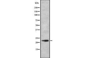 Western blot analysis of DRD1IP using RAW264. (CALY Antikörper  (Internal Region))