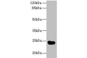 Western blot All lanes: GGTLC2 antibody at 2 μg/mL + Mouse kidney tissue Secondary Goat polyclonal to rabbit IgG at 1/10000 dilution Predicted band size: 24 kDa Observed band size: 24 kDa (GGTLC2 Antikörper  (AA 1-218))