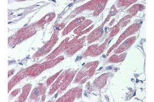 Human Heart: Formalin-Fixed, Paraffin-Embedded (FFPE) (STK39 Antikörper  (C-Term))