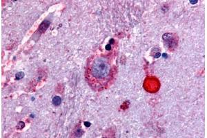 Anti-Delta Opioid Receptor antibody  ABIN1048496 IHC staining of human brain. (OPRD1 Antikörper  (Extracellular Domain))