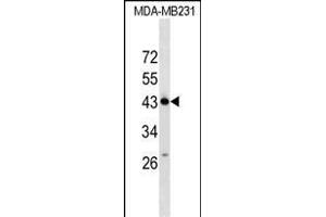 ZN Antibody (N-term) (ABIN1539540 and ABIN2849490) western blot analysis in MDA-M cell line lysates (35 μg/lane). (ZNF550 Antikörper  (N-Term))