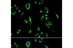Immunofluorescence analysis of MCF-7 cells using APOBEC3G Polyclonal Antibody (APOBEC3G Antikörper)