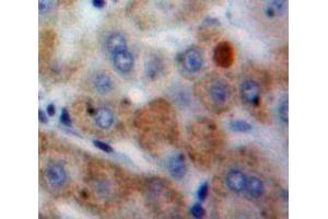 Used in DAB staining on fromalin fixed paraffin-embedded Liver tissue (CSTA Antikörper  (AA 1-98))