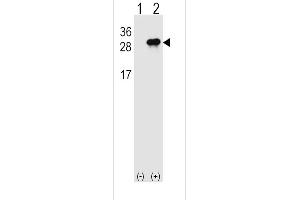Western blot analysis of IL28B (arrow) using rabbit polyclonal IL28B Antibody (N-term) (ABIN1539309 and ABIN2848533). (IL28B Antikörper  (N-Term))