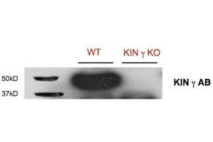 Western Blotting (WB) image for anti-SNF1-Related Protein Kinase Regulatory Subunit gamma 1 (KING1) (Regulatory Subunit Gamma) antibody (ABIN5326729) (KING1 Antikörper  (Regulatory Subunit Gamma))