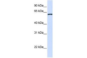 WDR40A antibody used at 1 ug/ml to detect target protein. (DCAF12 Antikörper  (Middle Region))