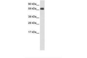 Image no. 1 for anti-T-Bet (AA 36-85) antibody (ABIN202727) (T-Bet Antikörper  (AA 36-85))