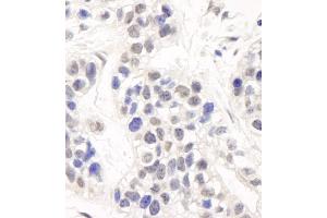 Immunohistochemistry (IHC) image for anti-DNA Cross-Link Repair 1C (DCLRE1C) (C-Term) antibody (ABIN7454515) (DCLRE1C Antikörper  (C-Term))