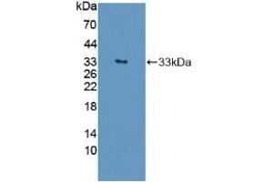 Detection of Recombinant SST, Human using Polyclonal Antibody to Autophagy Related Protein 16 Like Protein 1 (ATG16L1) (ATG16L1 Antikörper  (AA 342-607))