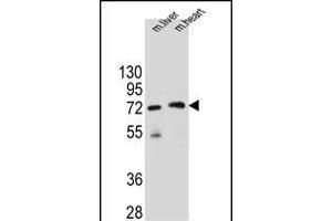 KCTD8 Antibody (C-term) (ABIN655546 and ABIN2845055) western blot analysis in mouse liver and heart tissue lysates (35 μg/lane). (KCTD8 Antikörper  (C-Term))