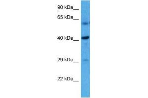 Host:  Rat  Target Name:  HSD11B2  Sample Tissue:  Rat Liver  Antibody Dilution:  1ug/ml (HSD11B2 Antikörper  (N-Term))