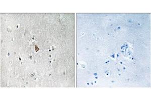Immunohistochemistry analysis of paraffin-embedded human brain tissue, using Insulin Like Growth Factor 1 Receptor (IGF1R) (Phospho-Tyr1346) antibody. (IGF1R Antikörper  (pTyr1346))