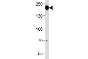 Epidermal Growth Factor Receptor antibody western blot analysis in A431 lysate