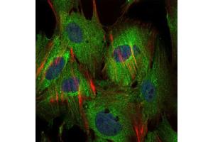 Immunofluorescence analysis of MSCS cells using BIRC5 antibody (green). (Survivin Antikörper)