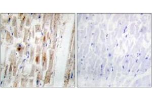 Immunohistochemistry analysis of paraffin-embedded human heart, using Smad1 (Phospho-Ser465) Antibody. (SMAD1 Antikörper  (pSer465))