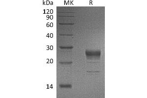 SDS-PAGE (SDS) image for Fibroblast Growth Factor 7 (FGF7) protein (His tag) (ABIN7455635)