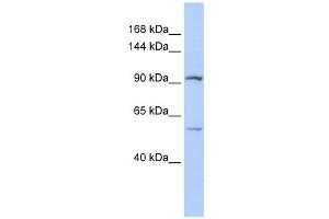 LRRC66 antibody used at 1 ug/ml to detect target protein. (LRRC66 Antikörper  (Middle Region))