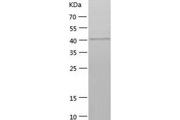 SSB Protein (AA 1-408) (His tag)