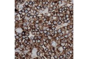 Immunohistochemical analysis of CD254 staining in human lymph node formalin fixed paraffin embedded tissue section. (RANKL Antikörper  (Center))