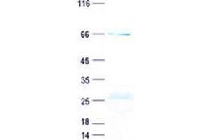 Western Blotting (WB) image for CD2 (CD2) protein (GST tag,His tag) (ABIN5505575)