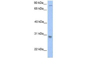 Western Blotting (WB) image for anti-Glutathione S-Transferase theta 1 (GSTT1) antibody (ABIN2459202) (GSTT1 Antikörper)