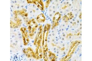 Immunohistochemistry of paraffin-embedded Rat kidney using SULT2A1 Polyclonal Antibody at dilution of 1:200 (40x lens). (SULT2A1 Antikörper)