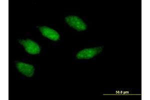 Immunofluorescence of purified MaxPab antibody to EGR2 on HeLa cell. (EGR2 Antikörper  (AA 1-476))