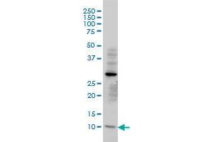 Western Blotting (WB) image for anti-Translocase of Inner Mitochondrial Membrane 8A (TIMM8A) (AA 9-97) antibody (ABIN560598)