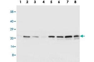 Western blot analysis of tissue and whole cell extracts with SOCS2 polyclonal antibody . (SOCS2 Antikörper  (C-Term))