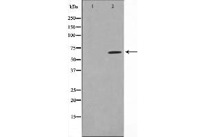 Western blot analysis on HeLa cell lysate using SGOL1 Antibody,The lane on the left is treated with the antigen-specific peptide. (Shugoshin Antikörper  (N-Term))
