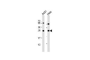 All lanes : Anti-PSPH Antibody (N-term) at 1:8000 dilution Lane 1: A431 whole cell lysate Lane 2: Hela whole cell lysate Lysates/proteins at 20 μg per lane.