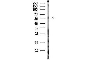 Western blot analysis of lysates from EC304 cells(heat-shock,45 min treatment), using Phospho-MLKL (Ser345) Antibody at 1/1000 dilution.