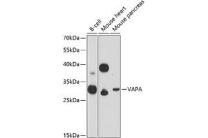 Western blot analysis of extracts of various cell lines, using VAPA Antibody (ABIN6132892, ABIN6150056, ABIN6150057 and ABIN6216758) at 1:3000 dilution. (VAPA Antikörper  (AA 137-227))