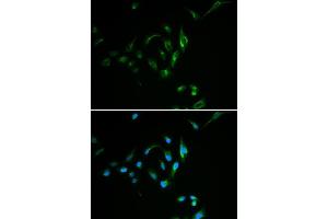 Immunofluorescence analysis of MCF7 cell using CPT2 antibody. (CPT2 Antikörper)