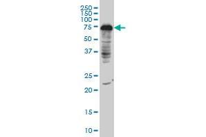 DCP1A monoclonal antibody (M06), clone 3G4 Western Blot analysis of DCP1A expression in IMR-32