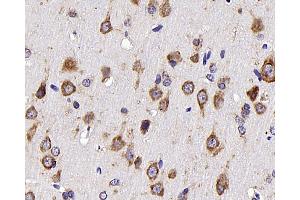 Immunohistochemistry analysis of parafffin-embedded rat brain using NTS Polyclonal Antibody at dilution of 1:300. (Neurotensin Antikörper)