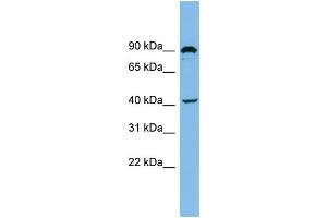 WB Suggested Anti-ZMYND12 Antibody Titration: 0. (ZMYND12 Antikörper  (N-Term))