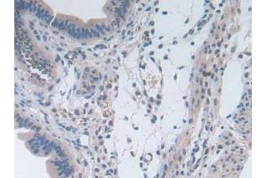 IHC-P analysis of Mouse Uterus Tissue, with DAB staining. (IL-2 Antikörper  (AA 10-169))
