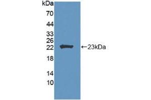 Western blot analysis of recombinant Human LCAT. (LCAT Antikörper  (AA 41-210))