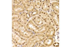 Immunohistochemistry (Paraffin-embedded Sections) (IHC (p)) image for anti-Acidic (Leucine-Rich) Nuclear phosphoprotein 32 Family, Member A (ANP32A) (AA 1-170) antibody (ABIN6136909)