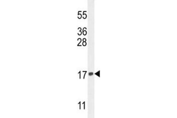 Histone H3.3 Antikörper  (Lys9)