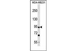 FSD2 Antikörper  (N-Term)