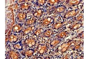 Immunohistochemistry of paraffin-embedded human small intestine tissue using ABIN7161885 at dilution of 1:100 (PPP1R9A Antikörper  (AA 1-243))
